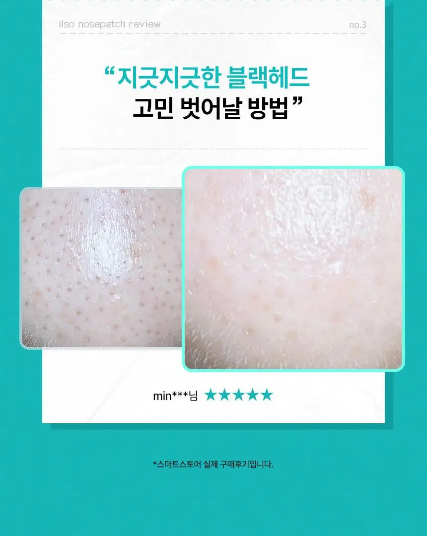 [1등코팩/피지순삭] 일소 네추럴 마일드 클리어 노우즈 팩 10매 (대용량) 상세페이지 9